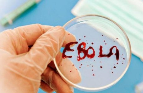 Ұлыбританияда эбола вирусына қарсы жаңа вакцина сынақтан өткізіле бастады